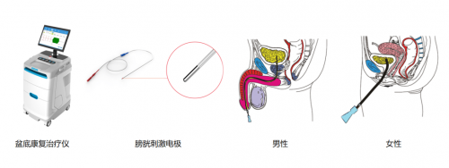 承诺医疗胫神经创新疗法治疗OAB获认可插图1