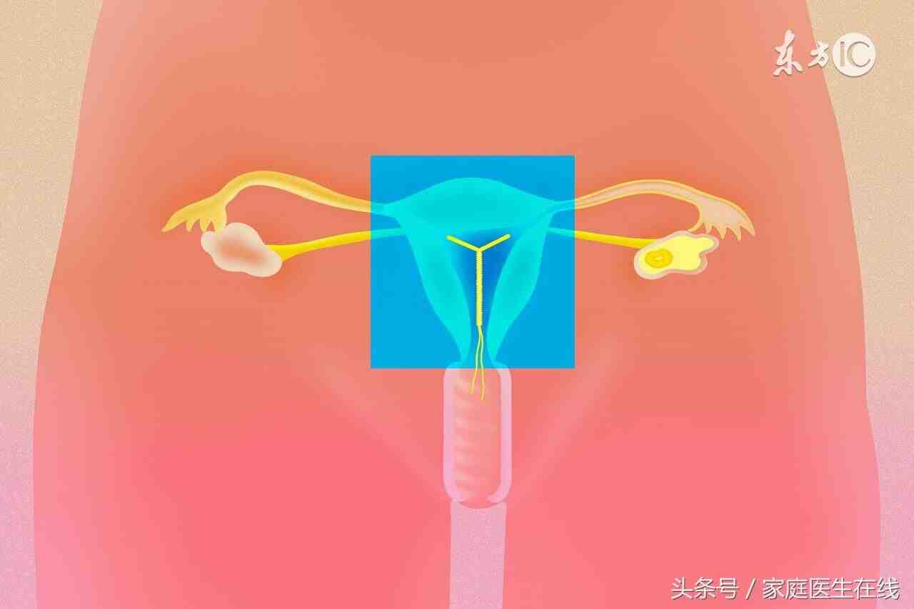 试管3次双胞胎好孕，试管流程、治疗方法、经验分享！插图1